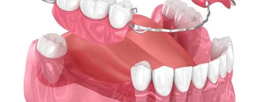 fixed and removable dentures